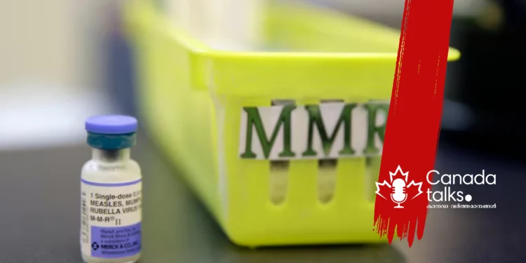 ഒന്റാറിയോയിൽ മീസിൽസ് രോഗികളുടെ എണ്ണം ഉയരുന്നു; വാക്സിനേഷൻ പ്രാധാന്യം വീണ്ടും ചർച്ചയാകുന്നു 1 ഒന്റാറിയോയിൽ മീസിൽസ് രോഗികളുടെ എണ്ണം ഉയരുന്നു; വാക്സിനേഷൻ പ്രാധാന്യം വീണ്ടും ചർച്ചയാകുന്നു