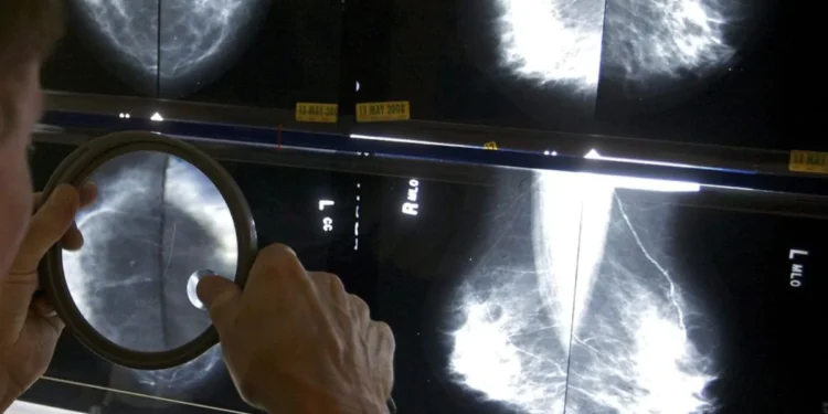 സ്ക്രീനിംഗ് മാർഗ്ഗ നിർദ്ദേശങ്ങൾ നിർത്തിവച്ചു 1 SCREENING