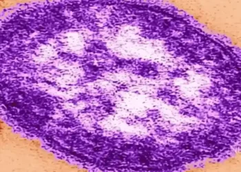 എഡ്മണ്ടനിൽ രണ്ട് മീസിൽസ് കേസുകൾ റിപ്പോർട്ട് ചെയ്തു 3 എഡ്മണ്ടനിൽ രണ്ട് മീസിൽസ് കേസുകൾ റിപ്പോർട്ട് ചെയ്തു