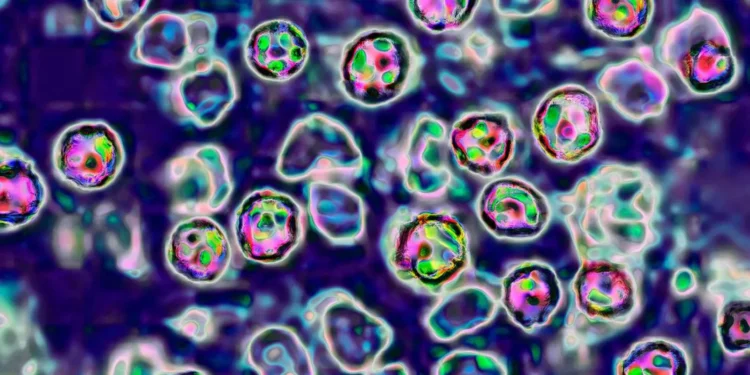 കോബ്ഡൻ, പെറ്റവാവയിൽ മീസിൽസ് ജാഗ്രതാ മുന്നറിയിപ്പ് 1 കോബ്ഡൻ, പെറ്റവാവയിൽ മീസിൽസ് ജാഗ്രതാ മുന്നറിയിപ്പ്