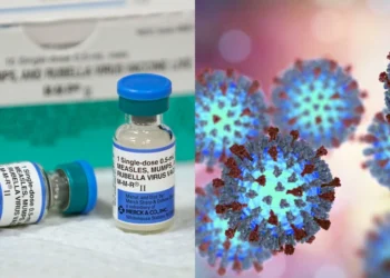 അടിയന്തിര ജാഗ്രത; ആൽബർട്ടയിൽ അഞ്ചാംപനി വ്യാപനം