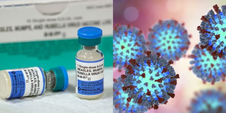 അടിയന്തിര ജാഗ്രത; ആൽബർട്ടയിൽ അഞ്ചാംപനി വ്യാപനം