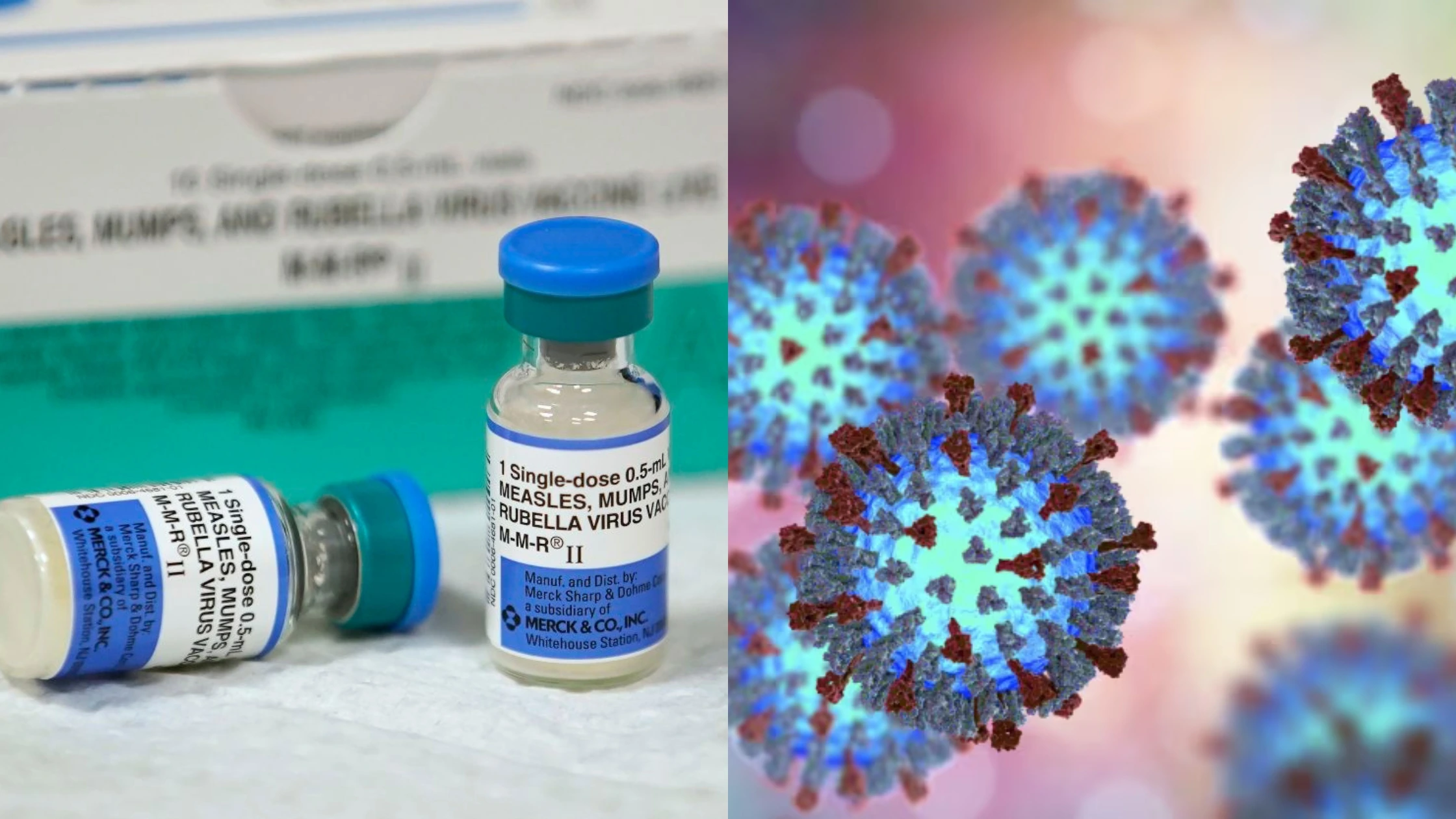 അടിയന്തിര ജാഗ്രത; ആൽബർട്ടയിൽ അഞ്ചാംപനി വ്യാപനം