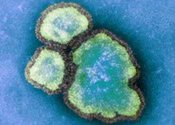 മീസിൽസ് പകർച്ചവ്യാധി