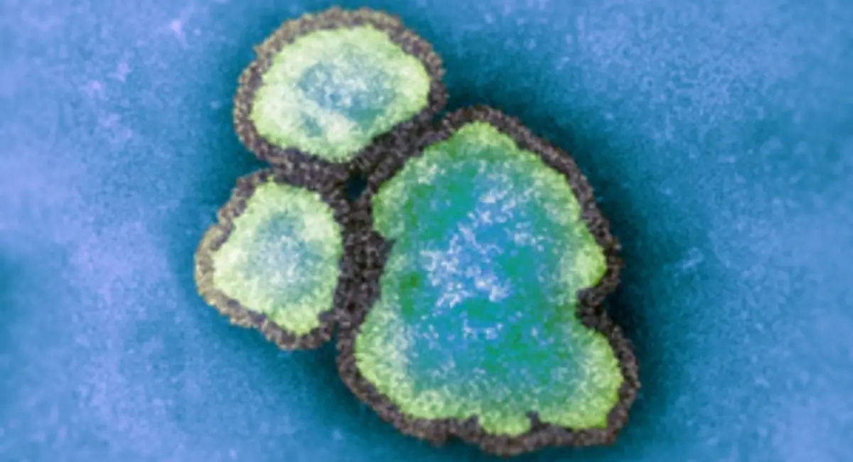 മീസിൽസ് കേസുകൾ 800 കടന്നു