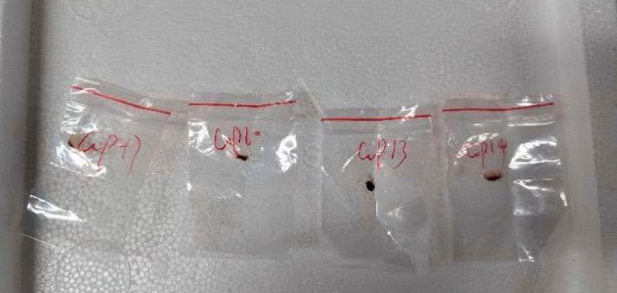 അപകടകാരിയായ ഫംഗസിനെ അമേരിക്കയിലേക്ക് കടത്തി; രണ്ട് ചൈനീസ് ഗവേഷകർ അറസ്റ്റിൽ