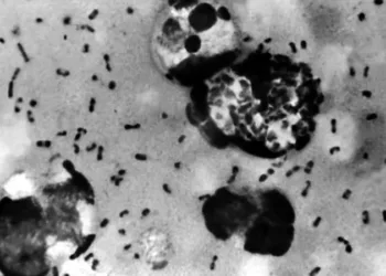 അരിസോണയിൽ പ്ലേഗ് ബാധിച്ച് ഒരാൾ മരിച്ചു!; 14-ാം നൂറ്റാണ്ടിലെ 'ബ്ലാക്ക് ഡെത്ത്' തിരികെ വരുമ്പോൾ 1 അരിസോണയിൽ പ്ലേഗ് ബാധിച്ച് ഒരാൾ മരിച്ചു!; 14-ാം നൂറ്റാണ്ടിലെ ‘ബ്ലാക്ക് ഡെത്ത്’ തിരികെ വരുമ്പോൾ