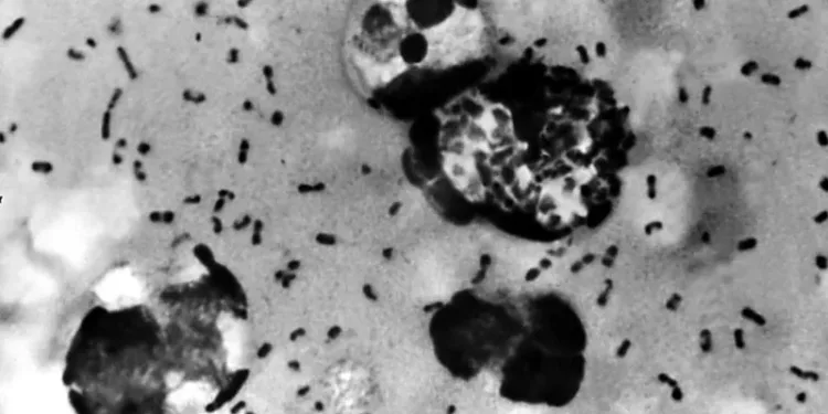 അരിസോണയിൽ പ്ലേഗ് ബാധിച്ച് ഒരാൾ മരിച്ചു!; 14-ാം നൂറ്റാണ്ടിലെ 'ബ്ലാക്ക് ഡെത്ത്' തിരികെ വരുമ്പോൾ 1 അരിസോണയിൽ പ്ലേഗ് ബാധിച്ച് ഒരാൾ മരിച്ചു!; 14-ാം നൂറ്റാണ്ടിലെ ‘ബ്ലാക്ക് ഡെത്ത്’ തിരികെ വരുമ്പോൾ