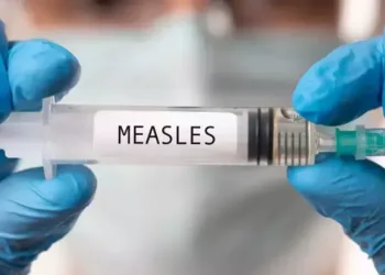 MEASLES