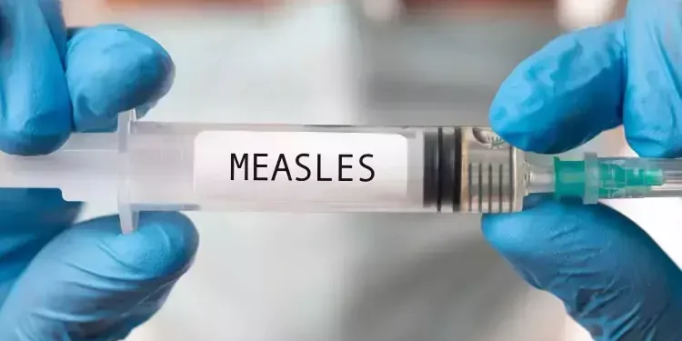 കാനഡയുടെ കിഴക്കൻ പ്രവിശ്യകളിൽ മീസിൽസ് വ്യാപനം; ന്യൂ ബ്രൺസ്വിക്കിലും നോവാ സ്കോഷ്യയിലും രോഗബാധ 1 MEASLES