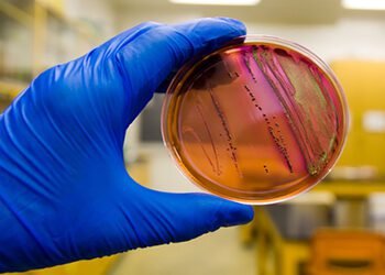 Ecoli