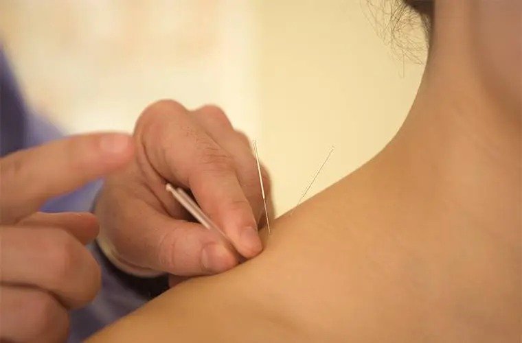 രോഗിയുടെ അനുമതിയില്ലാതെ ചികിത്സ; അക്യുപങ്ചറിസ്റ്റിനെതിരെ നടപടി