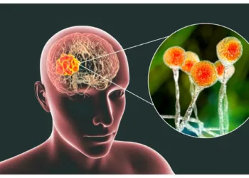 Amebic encephalitis