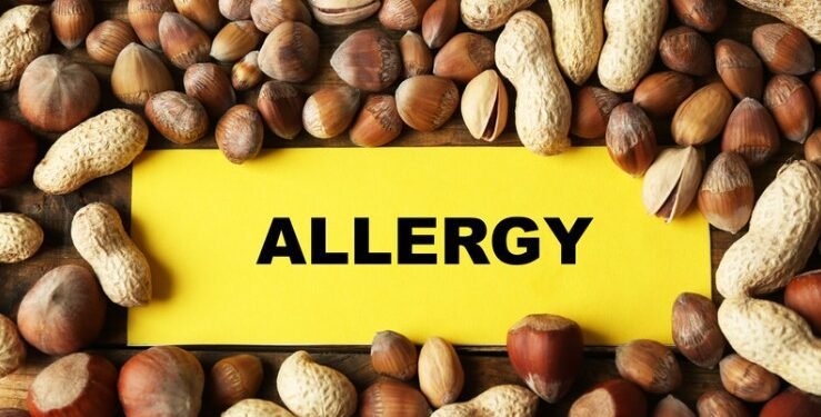 പീനട്ട് എന്ന രക്ഷകൻ: 60,000 കുഞ്ഞുങ്ങൾക്ക് അലർജിയിൽ നിന്ന് മോചനം; പഠനം നൽകുന്നത് ആശ്വാസ വാർത്ത!