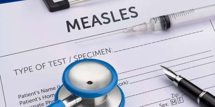 ഒട്ടാവ പള്ളികളിൽ മീസിൽസ് രോഗബാധ സാധ്യത; മുന്നറിയിപ്പുമായി OPH 1 Measles