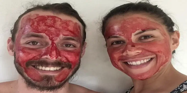 സൗന്ദര്യ സംരക്ഷണത്തിൽ ഒരു അതിരു കടക്കൽ; ആർത്തവരക്തം ഫേഷ്യൽ മാസ്കായി ഉപയോഗിക്കുന്ന ട്രെൻഡ് വൈറൽ 1 menstrual blood are said to be excellent for skin health