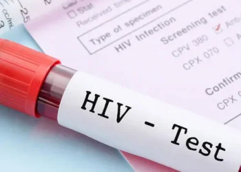 HIV TEST