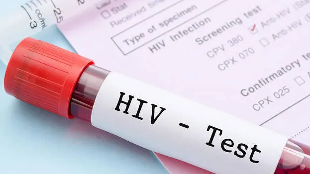 HIV TEST