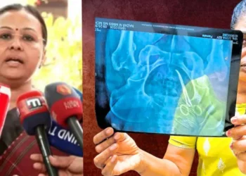 ശസ്ത്രക്രിയക്കിടെ വയറ്റിൽ കത്രിക കുടുങ്ങിയ സംഭവം: ഗുരുതര വീഴ്ചയെന്ന് മന്ത്രി വീണാ ജോർജ്; കർശന നടപടിക്ക് നിർദ്ദേശം
