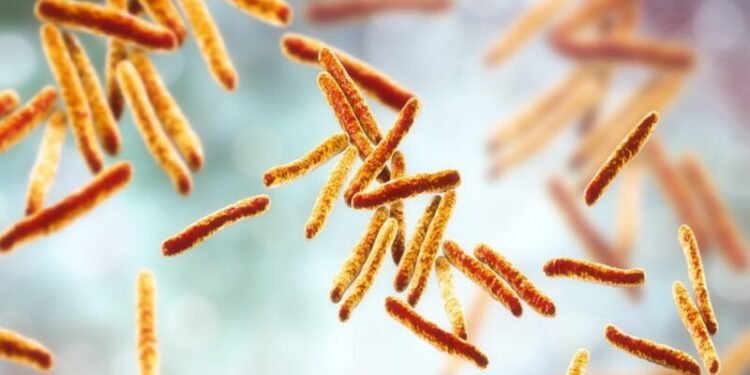 സസ്കാച്ചവാനെ നടുക്കി വീണ്ടും ക്ഷയരോഗം; രോഗവിവരങ്ങൾ സർക്കാർ മറച്ചുവെച്ചെന്ന് ആരോപണം, ആശങ്കയിൽ ജനങ്ങൾ