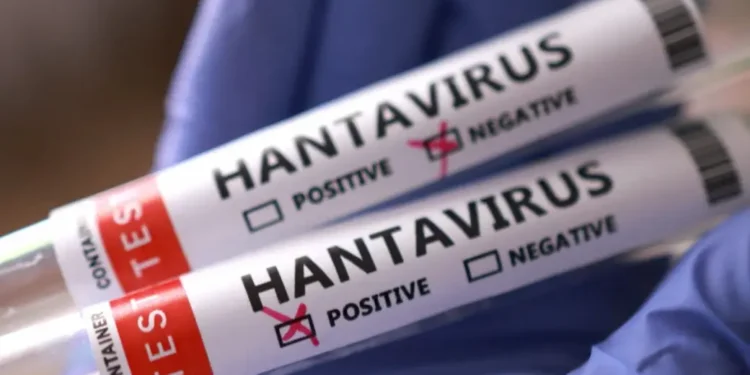 HANTAVIRUS