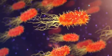 Legionnaires’ disease outbreak